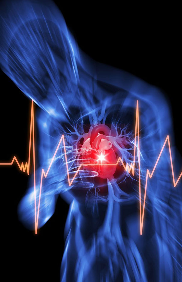 Cardiac Disease and Sudden Cardiac Arrest: Prevention, Response and Recovery