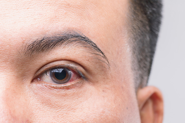 AI against glaucoma: Machine learning could aid early detection